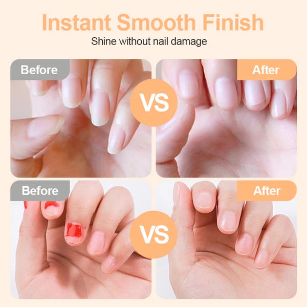 💗LAST DAY SALE 50% OFF⚡50K+ SOLD💕🌟2-in-1 Safe Electric Nail Clipper